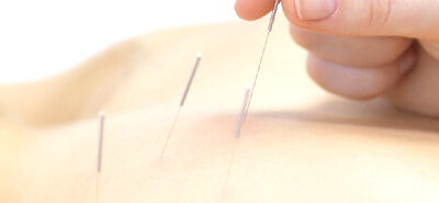 La acupuntura pincha ¿pero funciona?